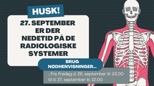 Grafik der illustrerer nedetid
